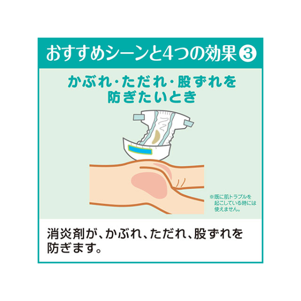 介護/医療】清拭剤 サニーナ 薬用スプレー状おしりふき 業務用400mL